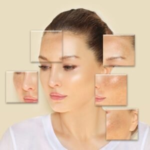 kuru ciltler için leke açıcı gündüz balm krem