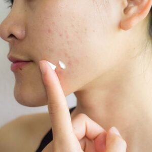 Acnéora Crème Réparatrice Anti-Imperfections Nuit