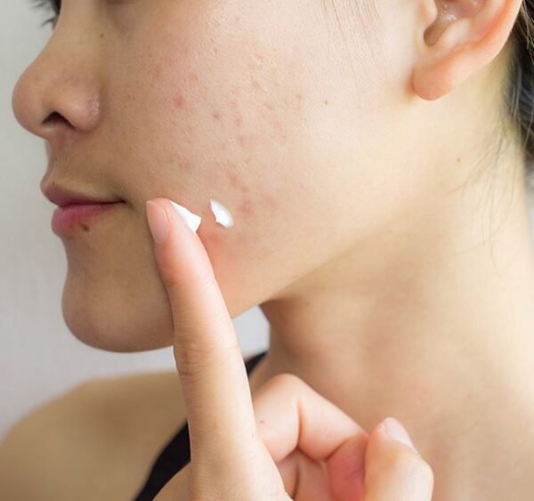 Acnéora Crème Réparatrice Anti-Imperfections Nuit
