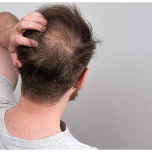Fortésia HOMME+ | Activateur & Défense