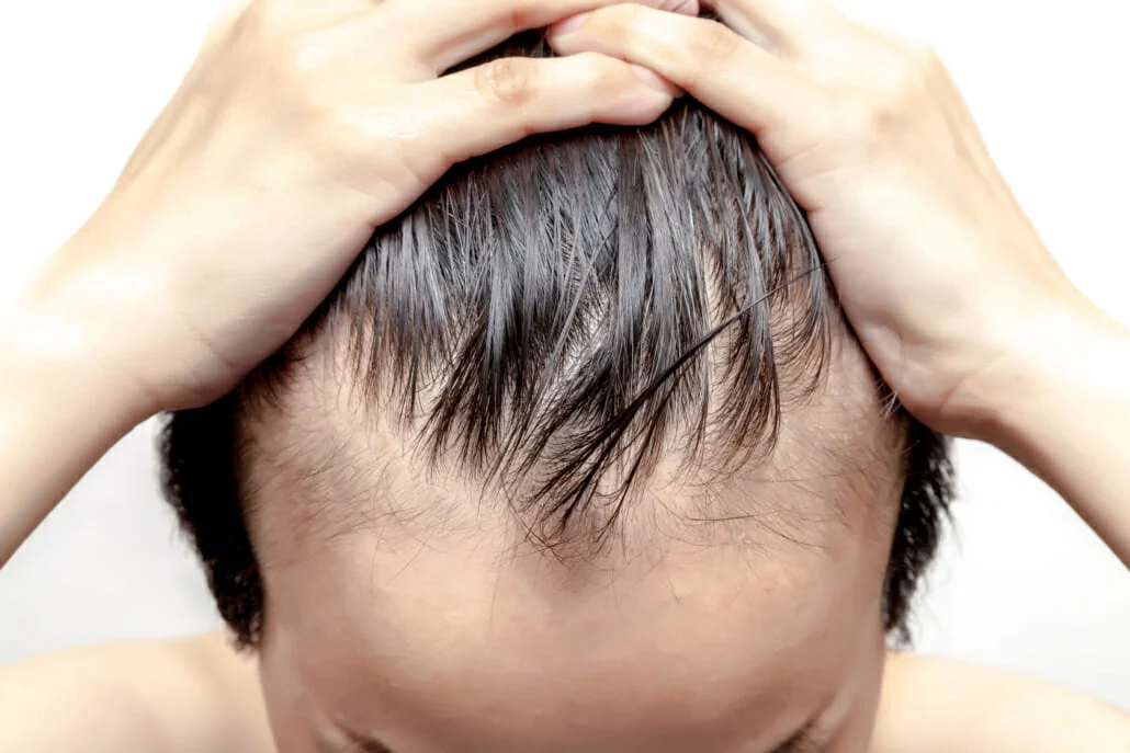 Yağlı Saç Derisinde Sebum Dengesi Neden Bozulur? Doğal Bir Yaklaşım: Équarome Pur-Balance Ritual